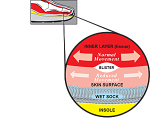 Blister Formation